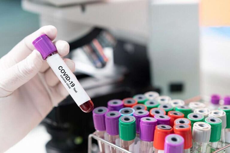 Türkiye’de son 24 saatte 15 bin 197 Coronavirus vakası tespit edildi